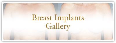 Breast Implants Gallery